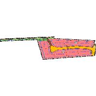 overview
